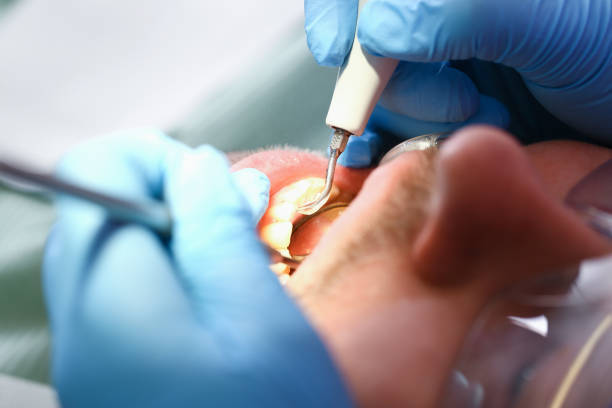Best Walk-In Emergency Dental Services in Cleves, OH